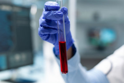 Анализ крови на гормоны в Пятигорске