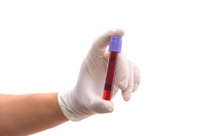 Как подготовиться к анализу крови