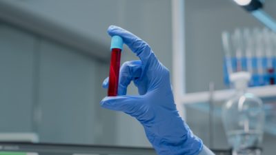 Анализ крови на ВИЧ показания