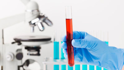 Биохимический и другие анализы крови